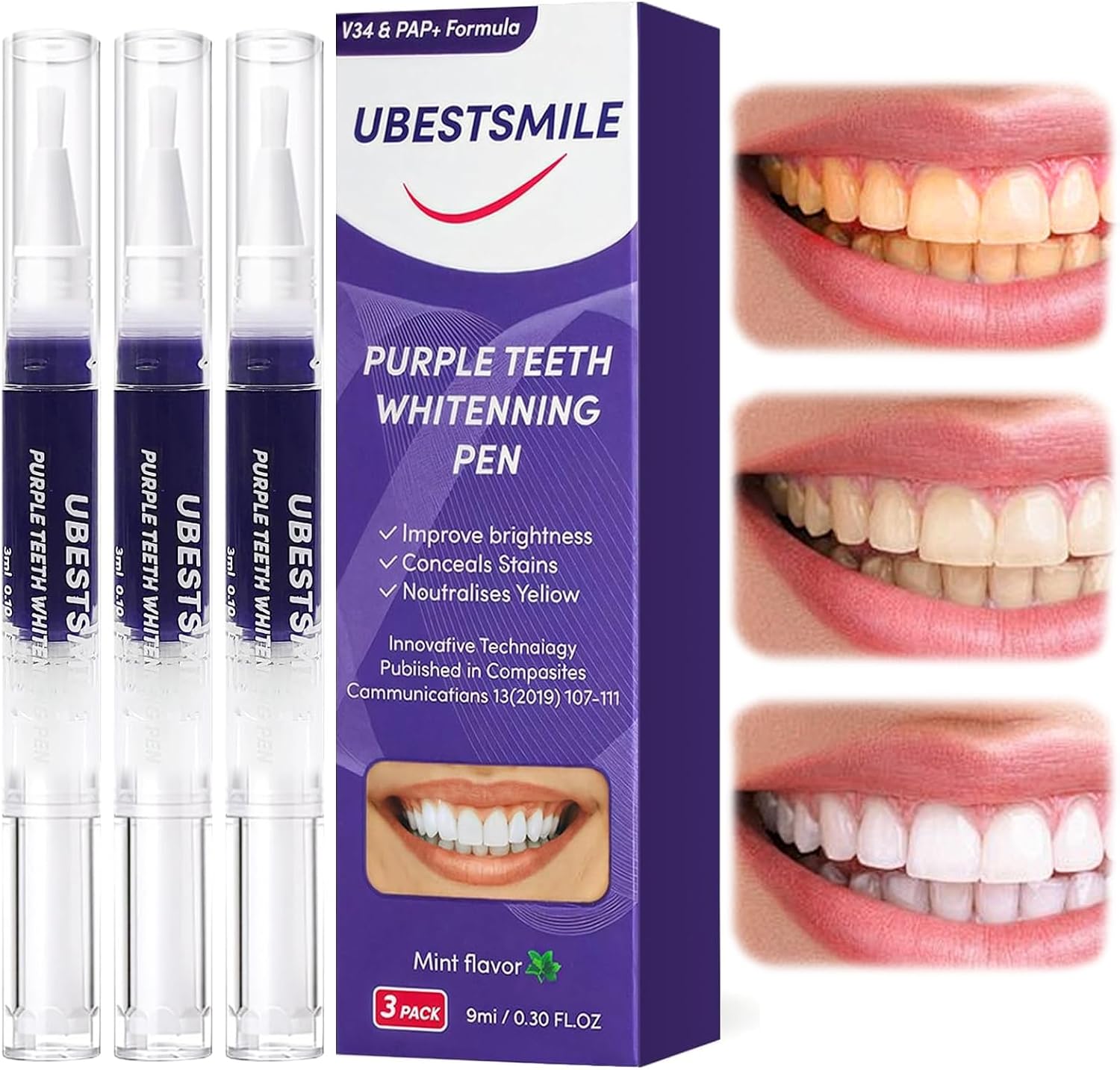 Teeth Whitening Pens - UBESTSMILE V34&PAP+ Formula Fioletowy Długopis Wybielający