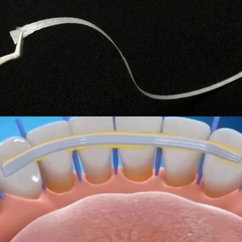 1/2/3/5 szt. Szkiełkowe szyny  – Teeth Whitening Strips Lumineux recenzja i cena