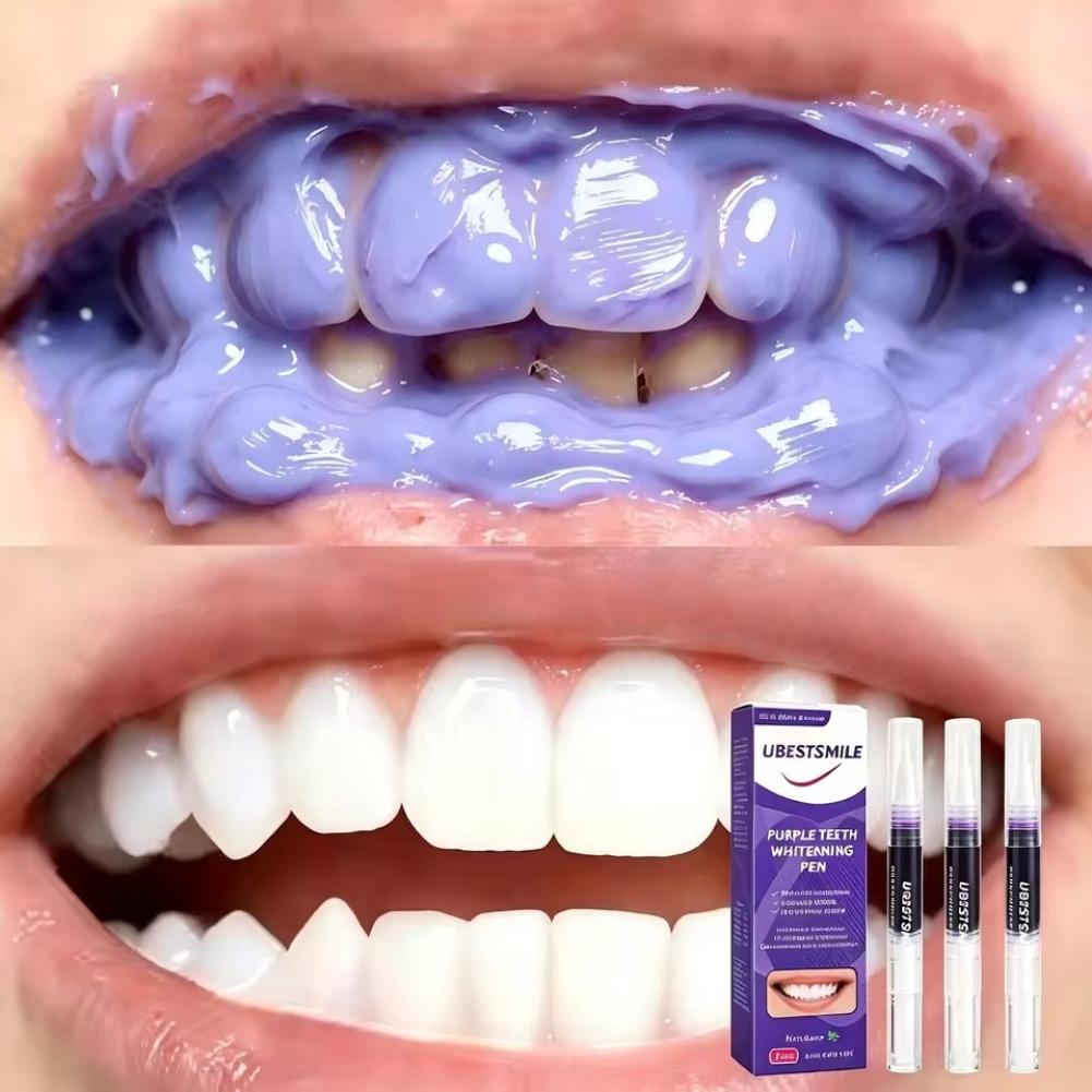 Fioletowy długopis do wybielan – Teeth Whitening Pens recenzja i cena