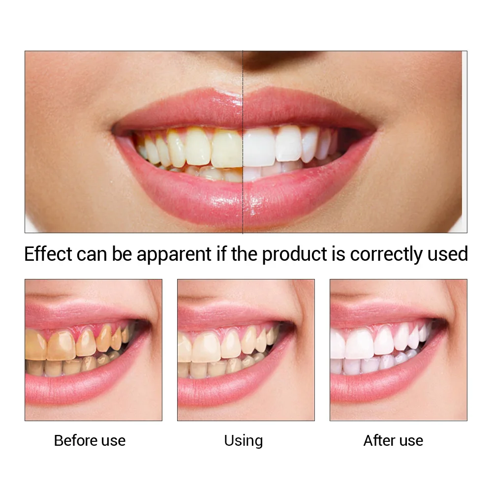 FTEENPLY esencja do wybielania – Teeth Whitening Results recenzja i cena
