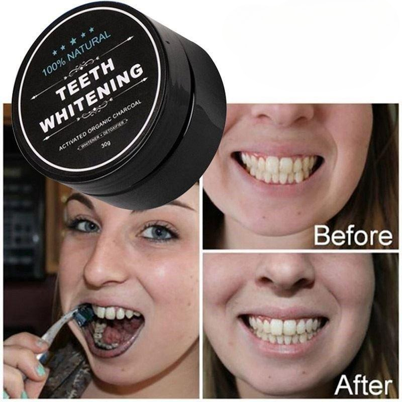 1 Pudełko Proszku do Wybielani – Teeth Whitening Results recenzja i cena
