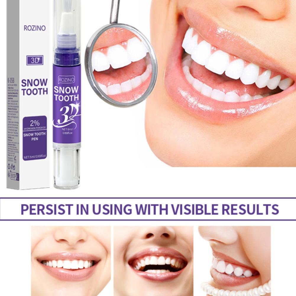 Przenośny długopis do wybielan – Teeth Whitening Pens recenzja i cena